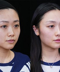 biu������ĺ���Ȼ�����ָ߼�������