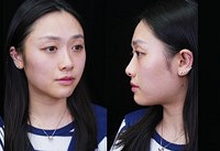 biu���Ӻ���Ȼ���Ҷ�ҽ������ӵ�С������С�