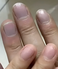 ���裡����ָ�׷��Ͼܾ�ҽ�������ͻ����ʹ��