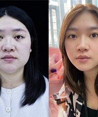 ���˿�˥��Ŀ������º�����״̬�䳬��