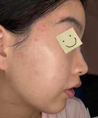 �󵨳����˻ƽ�΢��4����Ч���������̫���˰�