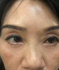 ԭ��ȥ�۴�����ô���ɣ��ָ��ú󣬿�������ܶ�