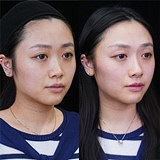 �ñ��ӱ�ͦ�ļ򵥷���