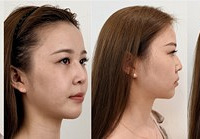 �����������룡����һ�����꼪����ʵ��˥Ч��
