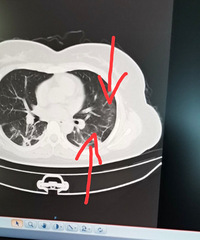 �人�����ռǣ����޶���������� 28 ��