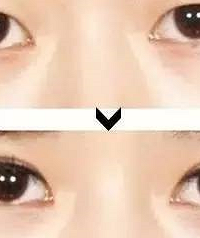 ���ǿ��Խ������ڵ�����Ů����˫��Ƥ��