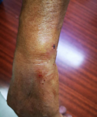 ���죡�㽭һ���˱���ҧ�˺�ȴ�����߶�