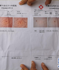 һ�׶�԰�����������ϳ����˲�������