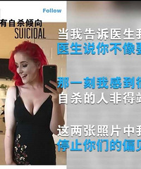 ���������羫�������գ�����֢����Щ֢״������