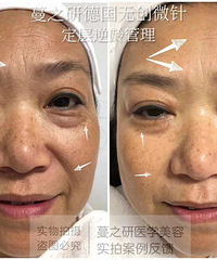 蔓之研加盟【实体店】吸金项目蔓之研骨针霜