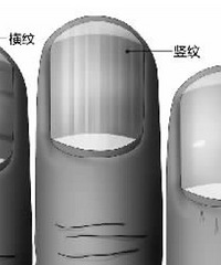 "指甲周围长倒刺 其实并非身体缺乏维生素的信号"