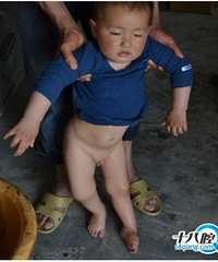 "糖丸致残,夺走了我儿子一生的健康"