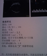 "40周+1,脐带绕颈两圈,医生建议剖,万能的19楼,催生加顺产……