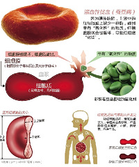 突发“蚕豆病”,差点救不回