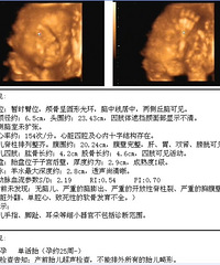 "附上四维彩超结果和唐氏筛查结果,想知道BABY性别"