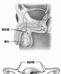 "意外怀孕 各种避孕方法失败率大PK"
