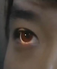 "武侠迷每天盯太阳练眼神 5天后视力模糊入院"