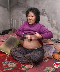"六旬老妇自称怀孕9个月 或将产下双胞胎(图)"