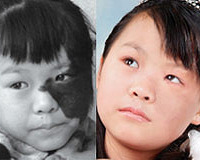【时光救助】 三地媒体爱心接力 云南少女杭州“变脸