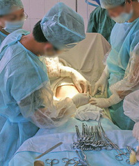 "宝宝是如何生出来的之剖腹产现场实拍"