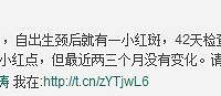 "崔玉涛谈常见病:血管瘤"
