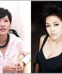 细数小S的“整形美容史”