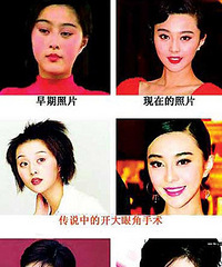 范冰冰整容前后 开眼角改脸型照片为证