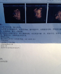 "24w+3 ◆四维彩超时间做太长◆医生都下班了,泪崩"