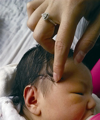 "剖腹产婴儿头上有伤口 被缝四针"