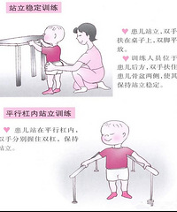 "小儿脑瘫治疗方法"
