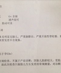 "33周+胎位不正,左骶前位,有经验的请进~"