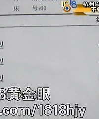 "寻找Rh AB型血型:“熊猫血”中的“熊猫血” "