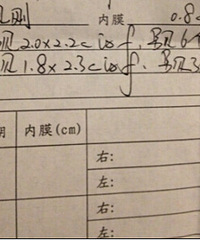 "第18天BC测排卵,两边都有优质卵泡,都会排掉吗,还是只排一侧?