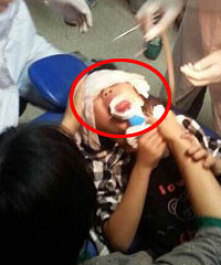 小女孩喝水舌头被乐扣杯卡了2小时…