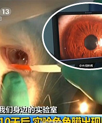 “美瞳”真的能美瞳吗? 真相简直触目惊心!