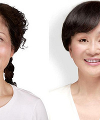 20名女子公布整容前后对比照 网友直呼大开眼界