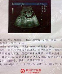 "【真实病例】女方双侧输卵管堵塞、男方弱精症夫妻同治治愈病例"