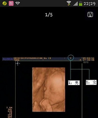 "b超单怎么看男女?有了B超单自己也能辨别性别"
