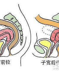 "子宫后位如何受孕 找对姿势很重要"