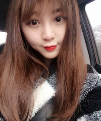 我在韩国做的双眼皮修复手术,真心挺好的