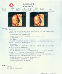 "四维彩超报告单帮我看一下是男是女,万分感谢! "