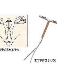 "什么时候上环最合适?孩子生够了想上环避孕"