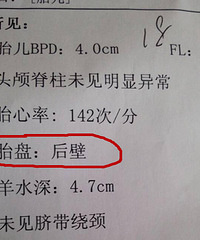 "胎盘后壁是什么意思?胎盘后壁生男生女?"
