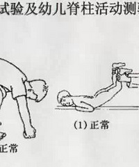 宝宝仅6个月就脊柱变形,原因竟然是……