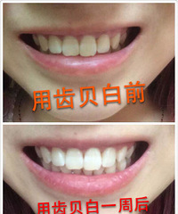 "我的牙很黄,每次刷牙,牙龈都会出血,从小"