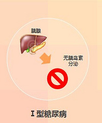 "教你如何辨别高血糖!"
