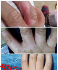 小孩子留疤真心疼老妈眼角的皱纹让人心塞小