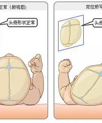 "宝宝头睡偏了怎么办?能睡定型枕吗?"