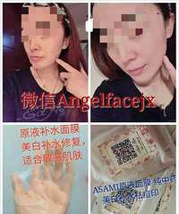 "分享祛痘秘方,快速祛痘去痘印的简单方法"
