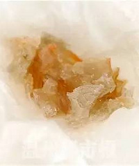 "100元一斤的大虾竟然被加了这种东西!当心你吃的虾! "